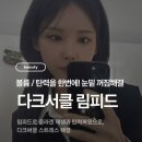 림피드 | 눈밑 다크서클 환해지는 림피드 시술후기