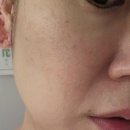 이니스프리 레티놀 앰플 바르는 법 순서, 모공 피부결 관리 내돈내산 후기
