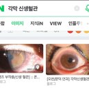 콘텍트렌즈 착용자 필독 생정 -렌즈 고르는 법- 이미지