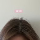 소담, 스물 셋 | 백일후애 탈모약 마이시딜 가격, 한달 75,000원 탈모 관리 결론은 ‘지속’