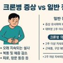 단순 배탈일까? 잦은 복통 설사 원인 크론병 초기 증상 의심 이미지