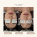 앤블랑뷰티 | 수기 테크닉으로 볼륨있는 얼굴형 라인 완성 김해 피부관리 블랑뷰티