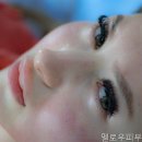 멜로우피부과의원 네이버블로그