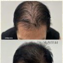 스테이 무아 이미지