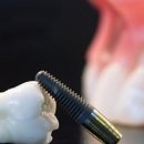 한스치과의원 이미지