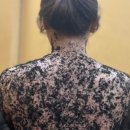 하리옴(쑥이사랑&에스테틱) 네이버블로그