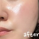 거친 피부결을 유연하게 만들어주는 압토솔 실키덤