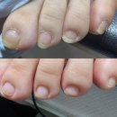 네일살롱바이선하 | 울산 풋케어전문샵 네일바이선 내성발톱 관리 방문 후기