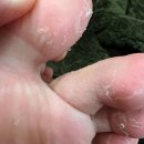 메디원스 이미지