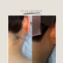 슈가헤어 | [시흥은계왁싱] 빠르고 통증없이 헤어라인왁싱 후기 ‘슈가무드왁싱’