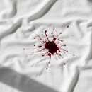 만능효소 | 피얼룩제거 방법 만능 얼룩제거제로 해결 후기