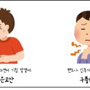 구풍 이미지