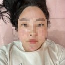 에르샤몽 연세강남의원 네이버블로그
