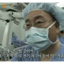 항우울제 치료 및 전기경련치료(ECT)에도 반응하지 않는 환자의 미주신경 자극술 치료 결과 이미지