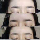 6429 | 대전눈썹탈각후기, 대전여자눈썹문신( 대전캐츠아이)