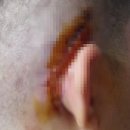 매직보청기 | 오른쪽 인공와우 수술 후기② 서울대병원 입원부터 퇴원까지(2022년 1~2월)