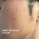 유소현 에스테틱 앤 아카데미 | 서울 송파구 볼리아에스테틱앤뷰티아카데미 알라딘필링 후기