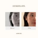 조은머리 | 진해피부관리 조은얼굴 에스테틱 후기, 눈코라인까지 또렷해진 윤곽관리!