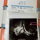 밝은미래산부인과의원 이미지