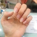 네일온제 이미지