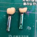 하모니치과기공소 네이버블로그