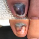 삼덕빌딩 | 거제 고현 젤 네일 잘하는곳 "비아네일" (+내성발톱 교정)