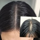 채움양꼬치 | 일산두피채움 두피관리 엘리시아 1회차 후기 일산호수공원가로수길 두피관리