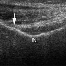 본큐어한의원 이미지