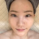 제이본에스테틱 | 불당동피부관리 제이본에스테틱에서 센스티브관리 받고 물광피부 불당동에스테틱