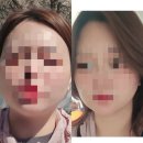 누룩꽃이핀다 - 금정구 금샘로 578 | 마운자로 한달차 후기 체중감량 눈바디 인바디 마운자로5mg 증량 부작용 후기 체중감량 마운자로 다이어트