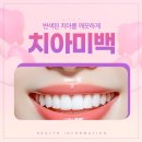 서울예봄치과의원 | 이대치과 근처 치아미백 솔직한 후기