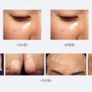 연세피부비뇨기과 이미지