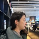 핑크멍 | 압구정피부과 목주름 필러 후기 벨로테로 리바이브 내돈내산 (통증, 엠보, 멍)