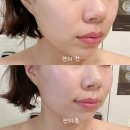 최현아에스테틱 | 광주 피부관리, 효과 좋은 윤곽관리! 최현아 에스테틱 후기