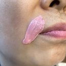 응달말로 | 탈모약 부작용으로 얼굴 인중 털 고민이라면? 구리왁싱으로 달라진 실제 후기