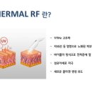 플라즈마 에스테틱 이미지