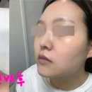 에멜리아(EMELIA)