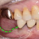 연세바로세움치과의원 이미지