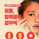 일광 이미지