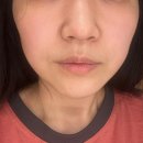 모티브성형외과의원 | W. 웨딩관리 : 에스테틱 중독자의 본식전 내돈내산 강남 신부관리 총정리👰🏻‍♀️ (+신랑 관리)