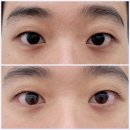 브래쉬