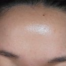 국홍일국정표피부과의원 이미지