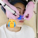 울산 달동 피부관리 에일린뷰티샵 아쿠아필 후기