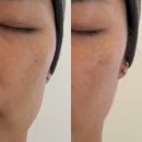 해운대소방서 | 해운대 피부관리 에스테티아 마린시티점 얼굴 라인 윤곽관리 후기