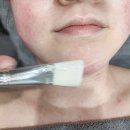 수연컴퓨터 | 대구 웨딩 피부관리 수연테라피 예신 솔직후기