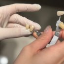 모아치과기공소 이미지