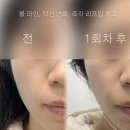 유제이 | 김해 두피관리 유제이뷰티 프리미엄 두피헤드스파 후기 리프팅까지 굿 김해 헤드스파 탈모관리 추천