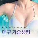 비엘성형외과의원 | 대구 모티바가슴성형 거울 앞에서 다시 웃고 싶은 그날