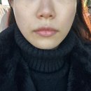 &lt;강변 뉴스킨&gt; 디바이스 제품 체험 후기