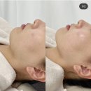 쌍문 윤곽관리 후기 잘하는곳 찾는다면